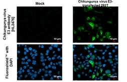 Anti-Chikungunya virus E3 antibody [HL2476] used in Immunocytochemistry/ Immunofluorescence (ICC/IF). GTX638825